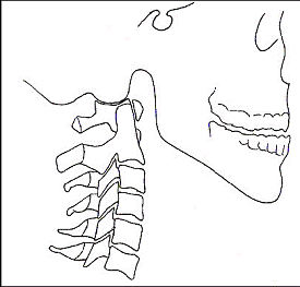 Schéma bočního snímku krční páteře